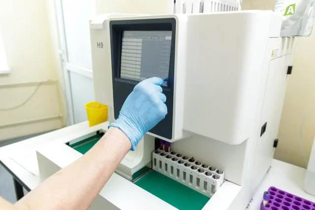 В больницу Люберец поступили аппараты для определения гликированного гемоглобина крови